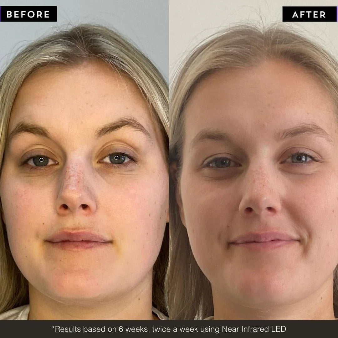 Maskology PHOTON LED light therapy face mask