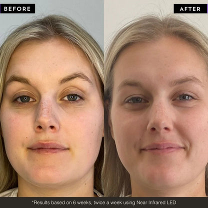 Maskology PHOTON LED light therapy face mask