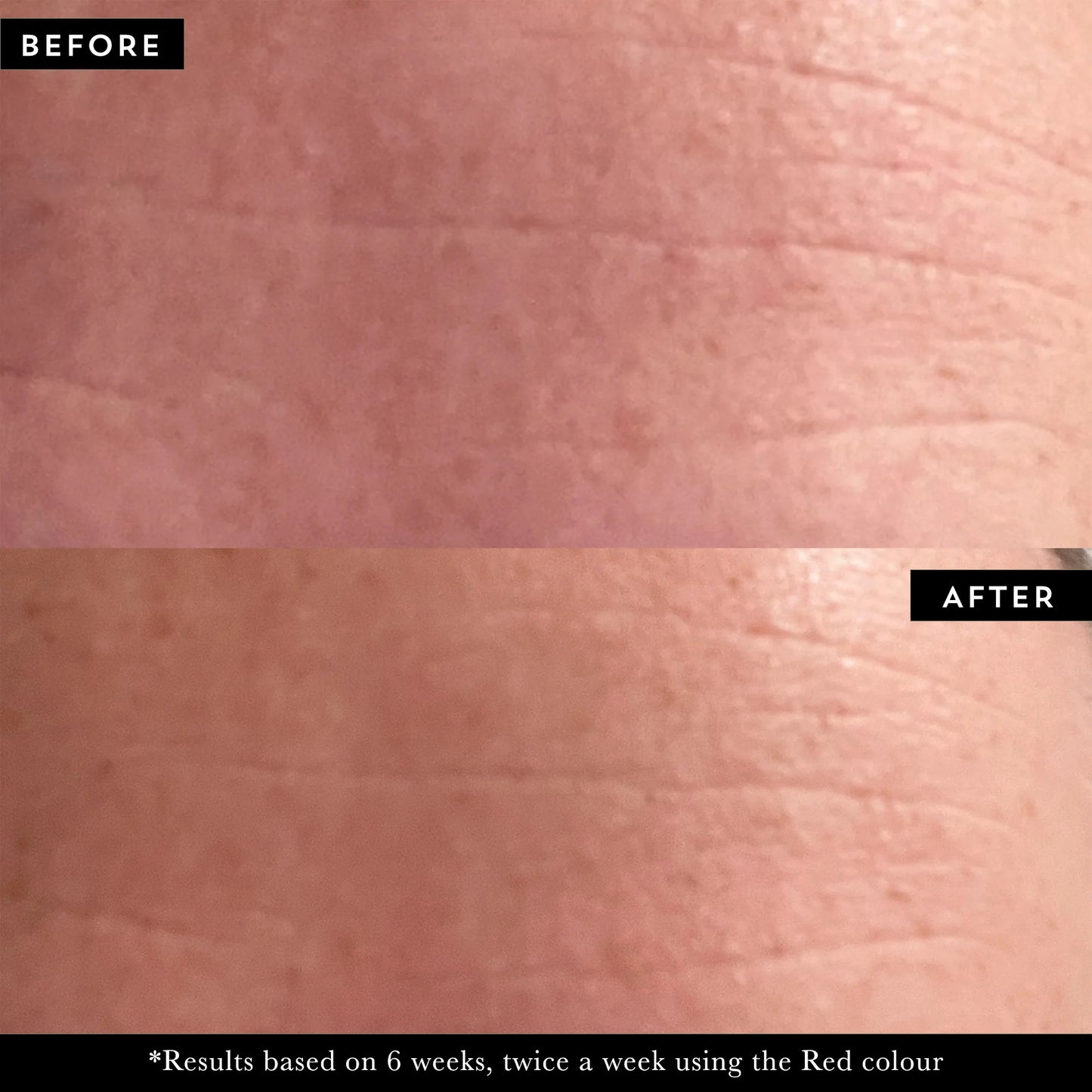 Maskology PHOTON LED light therapy face mask