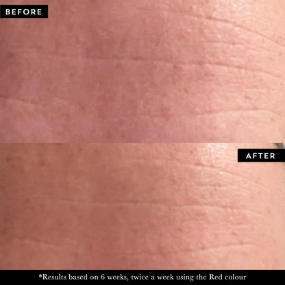 Maskology PHOTON LED light therapy face mask